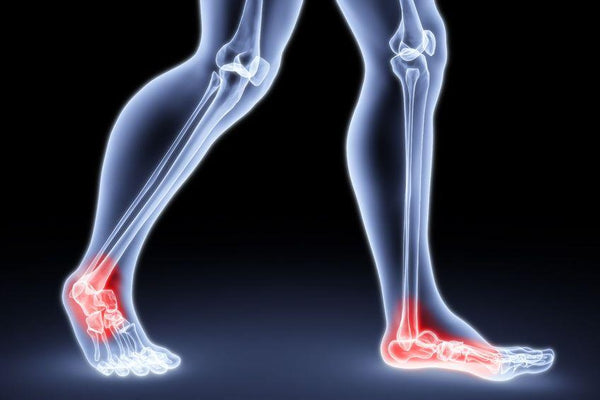 The Importance of Good Posture: How Can Orthopaedic Insoles Help?
